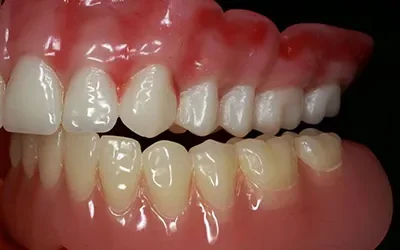 Unhappy With Your Denture…The Solution Is Simple (And It’s Not Always IMPLANTS)