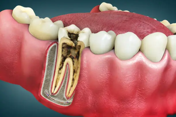 general-dentistry