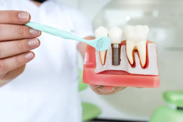 gum-treatment