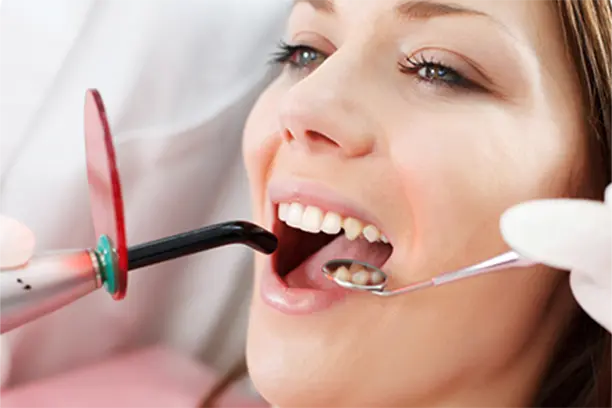 root-canal-treatment