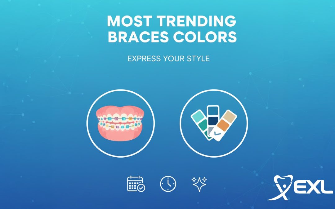 Most trending braces colors