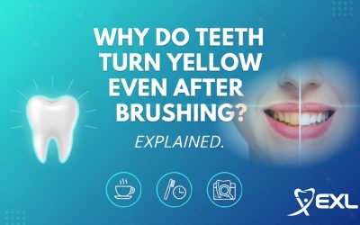 Why Do Teeth Turn Yellow Even After Brushing?