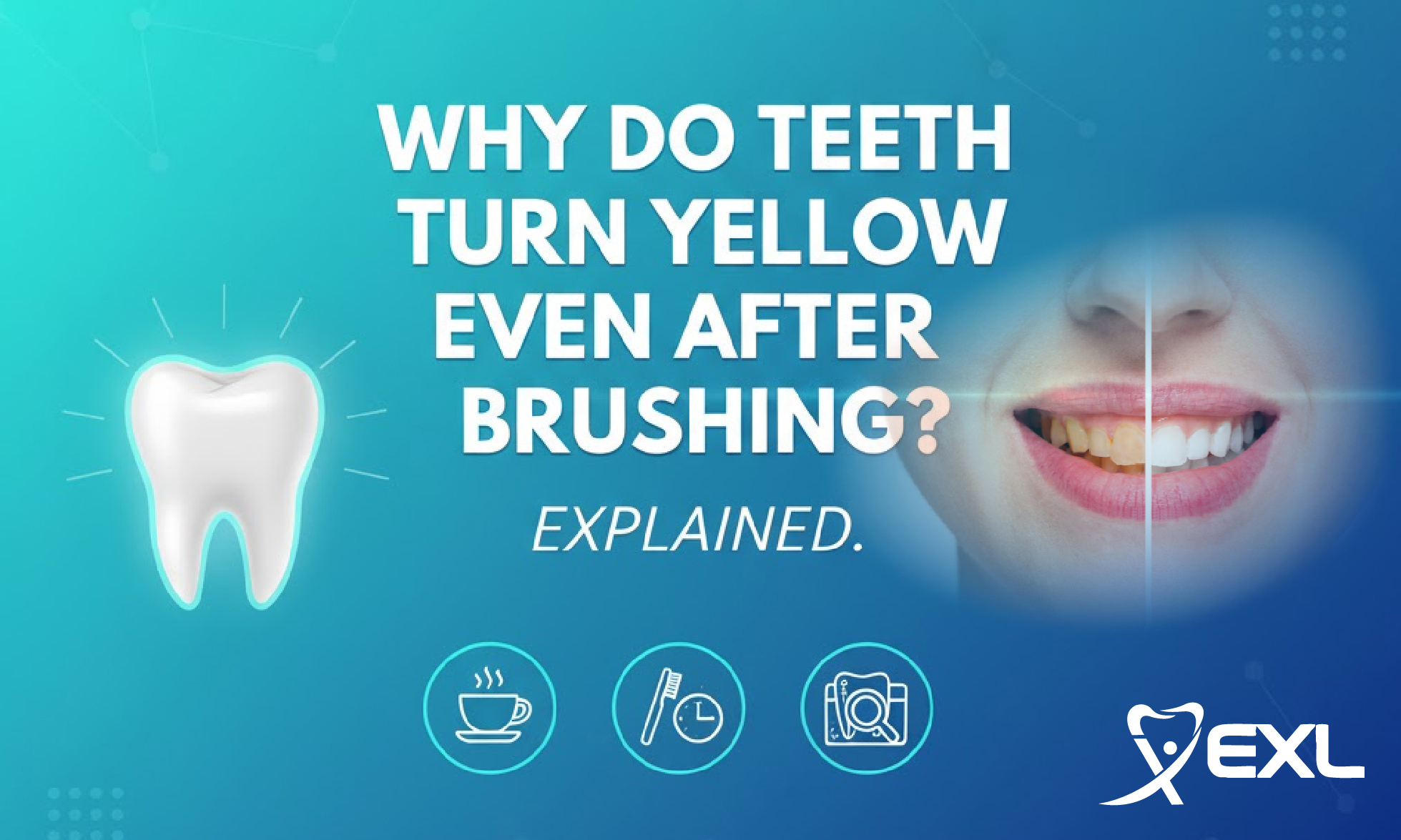 Why do teeth turn yellow even after brushing