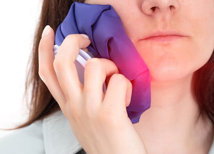 How to Manage Jaw Pain 2 Weeks After Root Canal