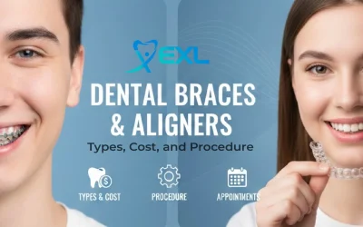 Dental Braces and Aligners: Types, Cost, and Procedure