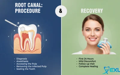 Root Canal: Procedure & Recovery