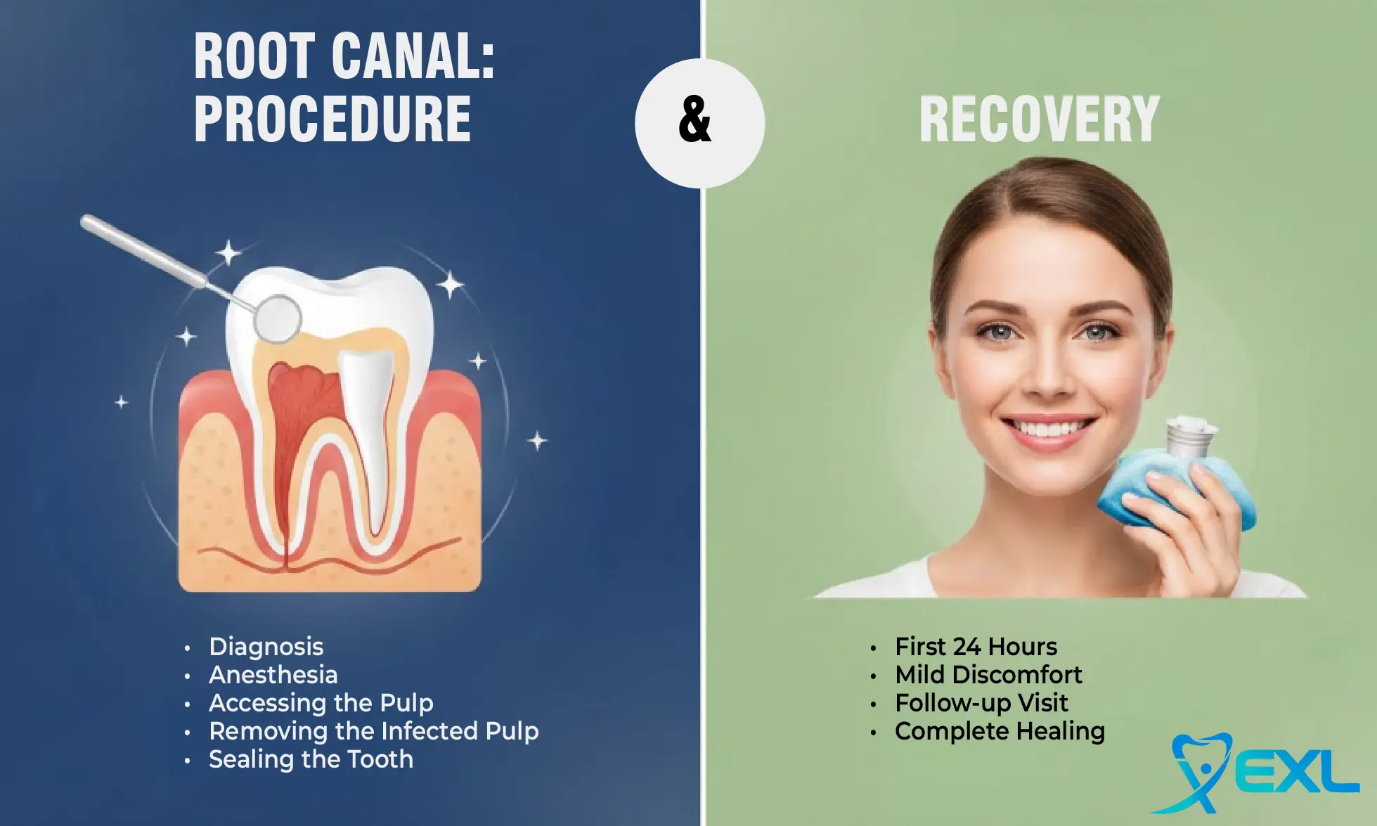 root canal procedure